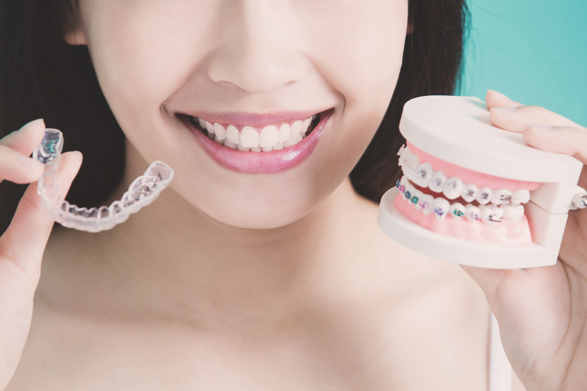 how much does invisalign cost in canada